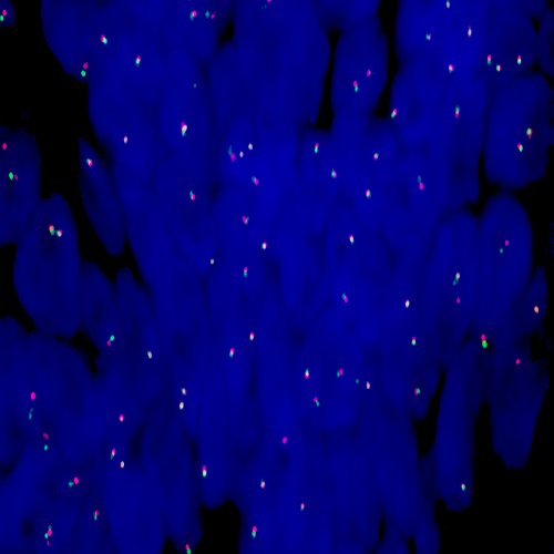 IVD ALK (2p23) Break - XL for BOND Produktfoto Front View S