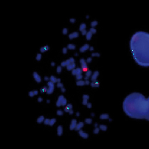 IVD CCND1 /SE 11 Produktfoto Front View S