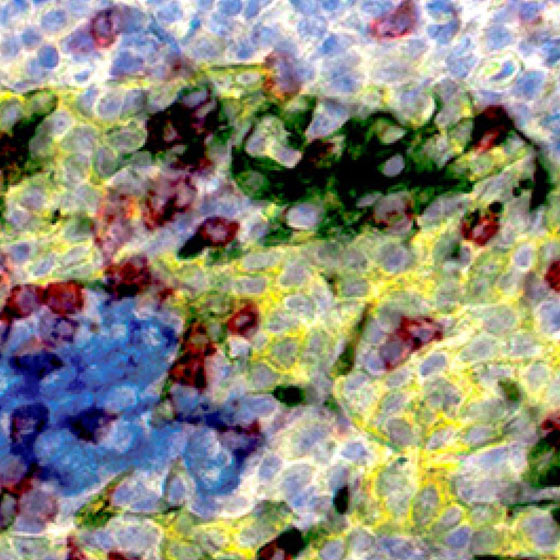 CP01-LBS mxIHC - PD-L1/CD8/PanCK Produktfoto