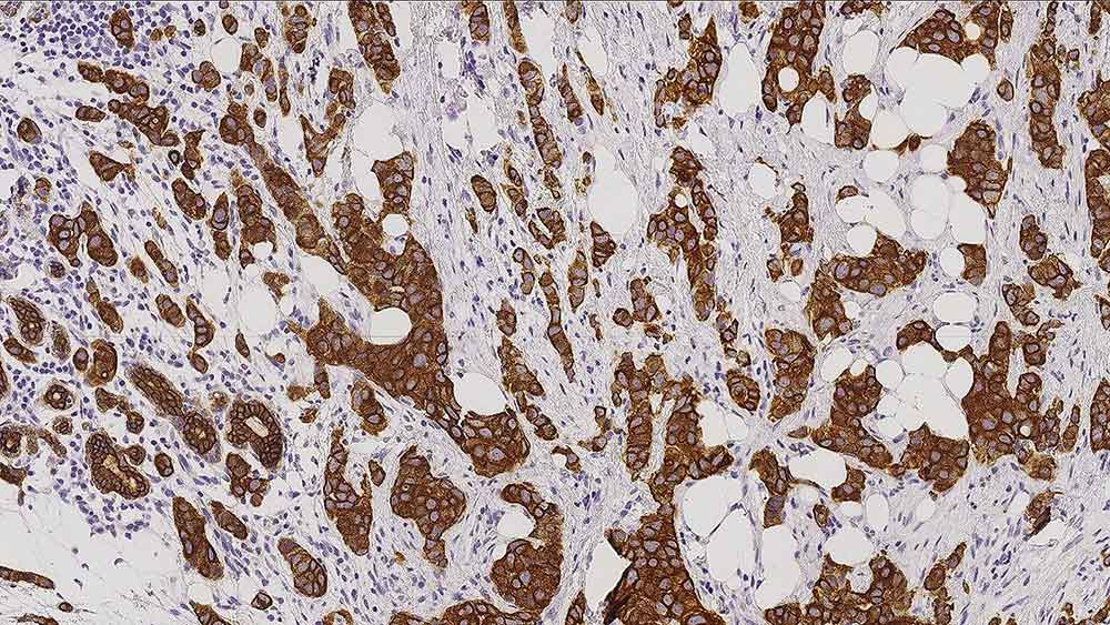 Cytokeratin 7 Produktfoto