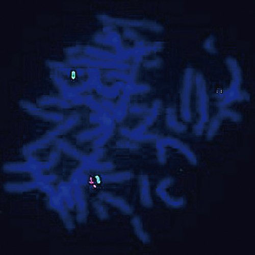 IVD DiGeorge II/SE 10 Produktfoto Front View S