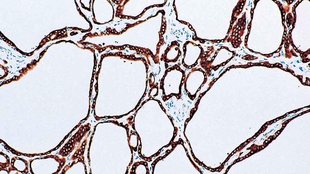 Thyroid Peroxidase Produktfoto