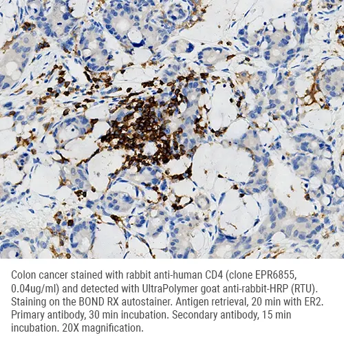 Anti-Rabbit IgG UltraPolymer HRP 15mL Produktfoto