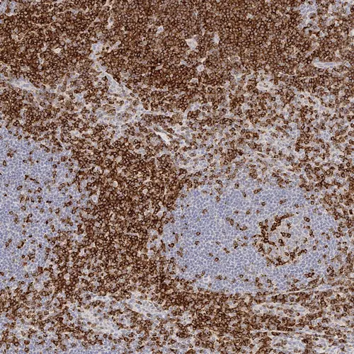 CD2 (LFA-2) Produktfoto Front View S