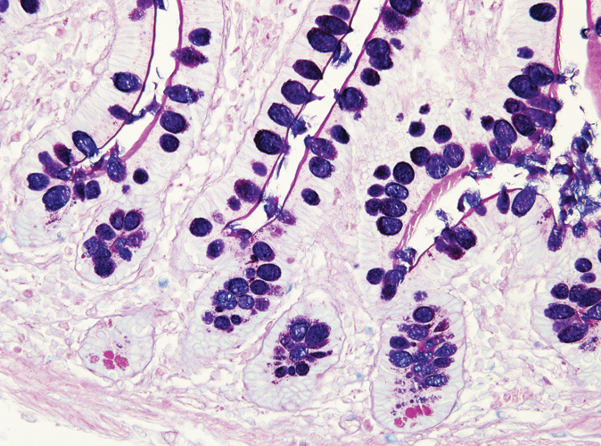 Alcian Blue and PAS Special Stain Kit Produktfoto Front View S