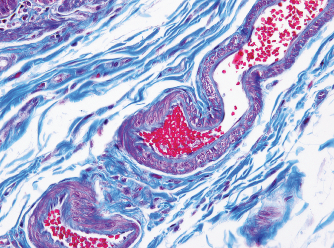 Gomori's Trichome Special Stain Kit (Blue collagen) Produktfoto Front View S