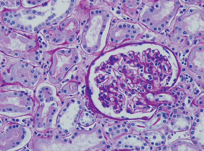 Periodic Acid and Schiff Special Stain Kit Produktfoto Front View S