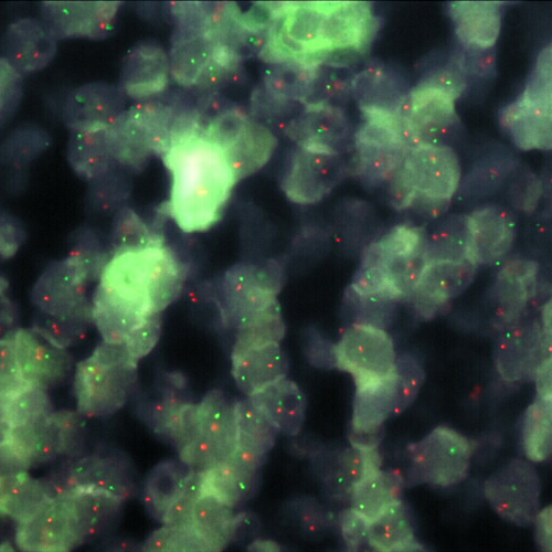 IVD EWSR1/NFATC product photo Front View S