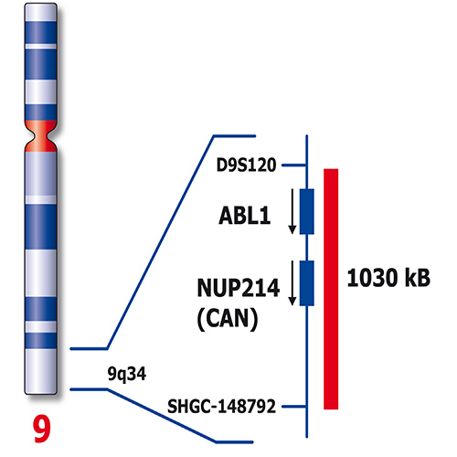 IVD DEK/NUP214 product photo Side View S