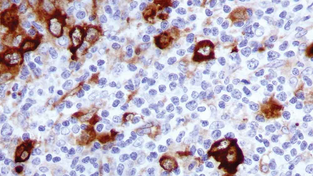1ml NCL-L-FASCIN product photo