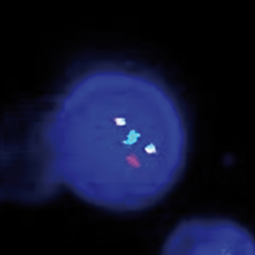 BCR/ABL1 t(9;22) Fusion, 20T product photo