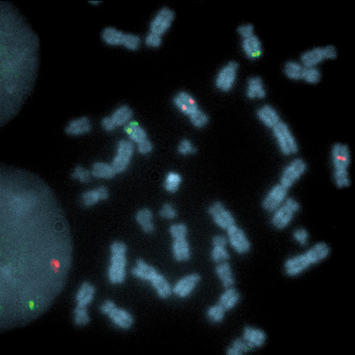 IVD ATM/GLI1 product photo