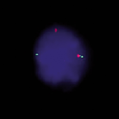 IVD SS18 Break product photo