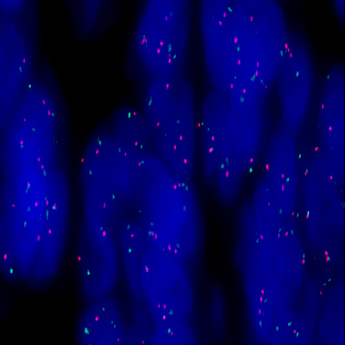 MET (7q31) / SE 7 (D7Z1) - XL for BOND product photo