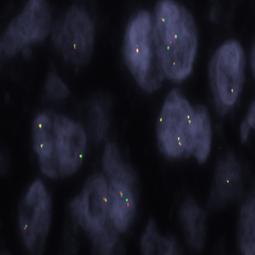FOXO1 (13q14) Break - XL for BOND product photo