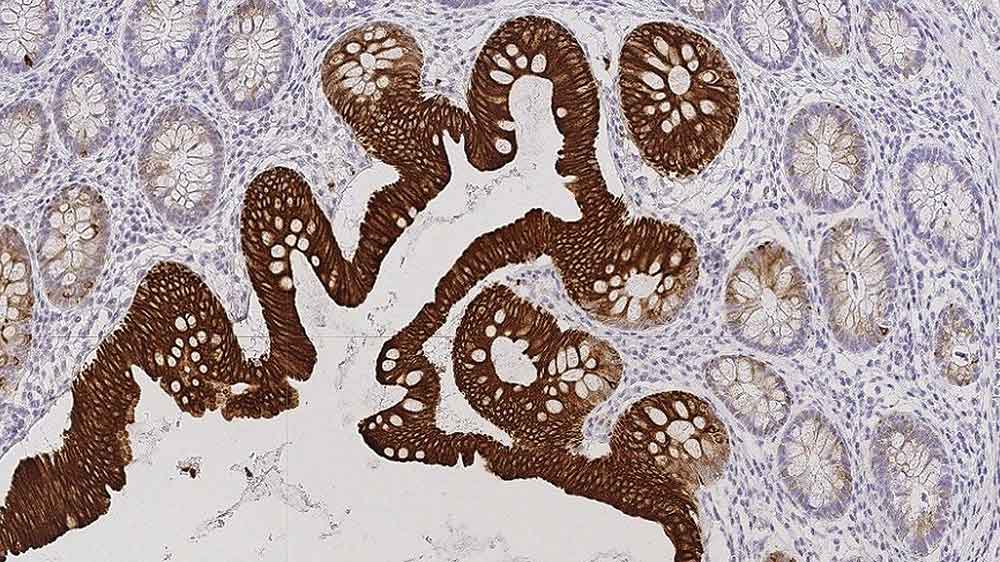 7ml Cytokeratin 20 Bond RTU Primary product photo