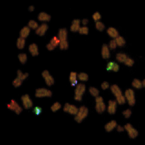 BCR/ABL1  t(9;22) TC, D-Fusion product photo