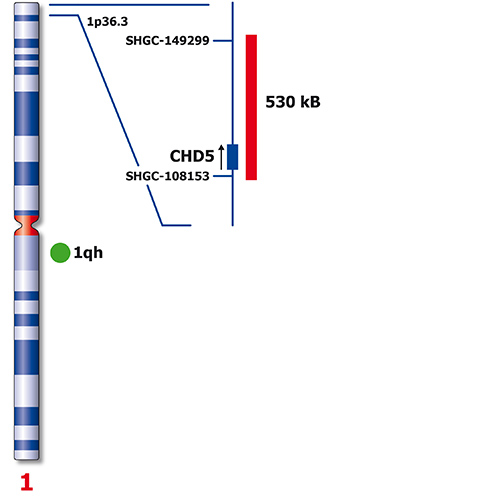IVD SRD/SE 1 photo produit Back View S