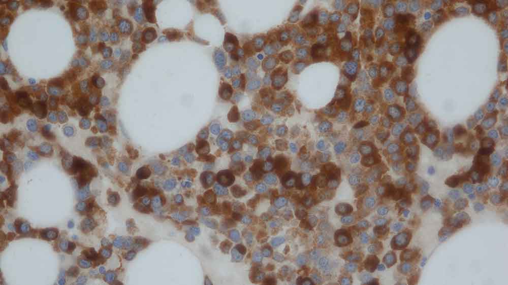 Lysozyme (Muramidase) photo produit