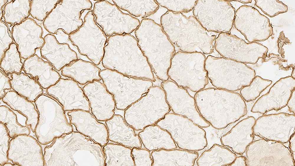 Spectrin photo produit Front View S