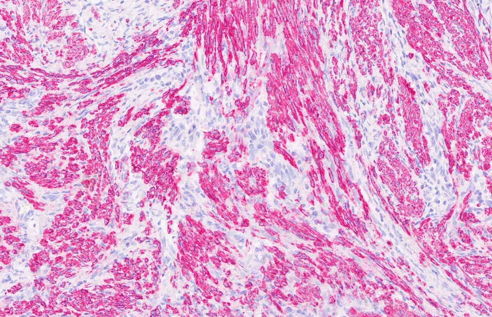 BOND-PRIME Polymer AP Detection System photo produit