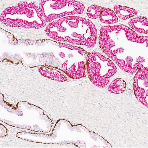BOND-PRIME ChromoPlex 1 Dual Detection photo produit