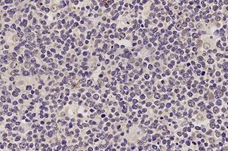 BOND RNA Negative Control Probe photo produit Front View S