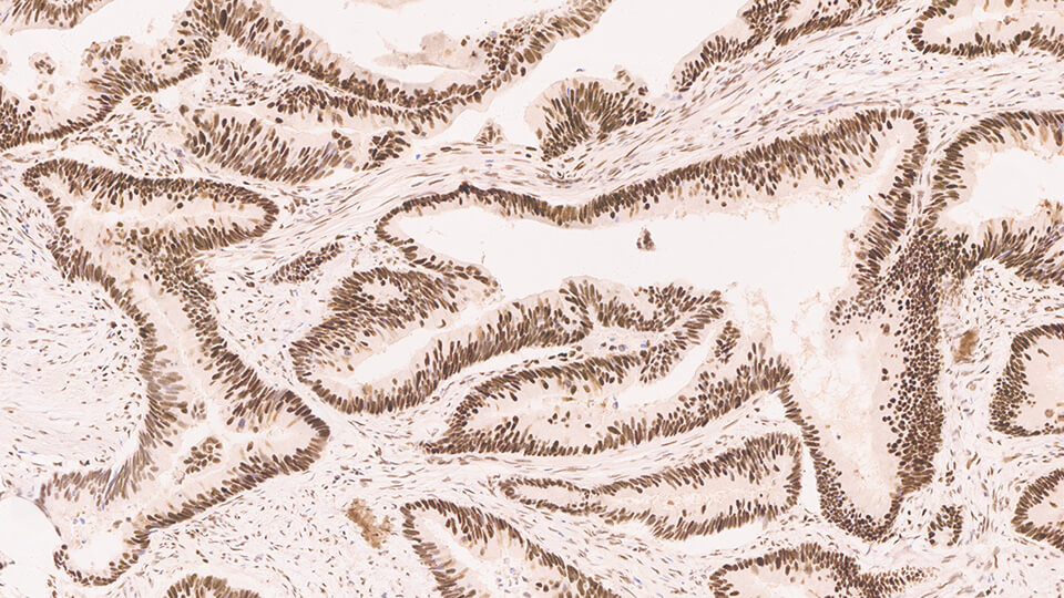 Mismatch Repair Protein (MSH6) photo produit Front View S