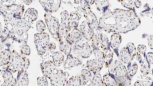 p57 Protein (Kip2) photo produit