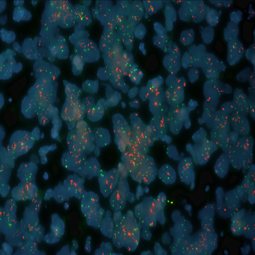 RUO - MET (7q31) / SE 7 (D7Z1) product photo