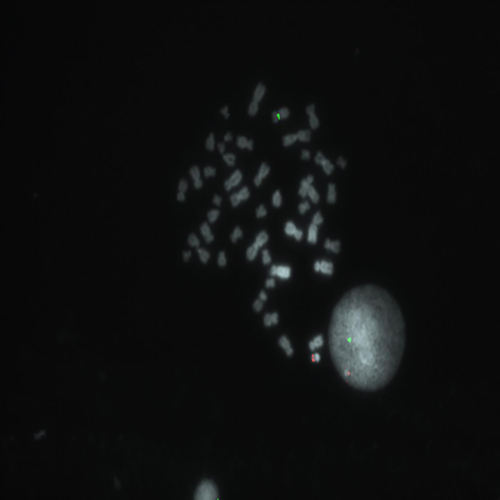 RUO - SE X (DXZ1) / SE Y (DYZ3) / SE 18 (D18Z1) product photo Front View S