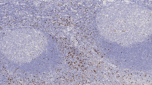 7mL FOXP3 (236A/E7) BOND RTU Primary product photo