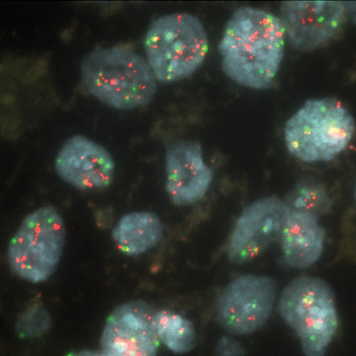 ERBB2 (17q12) / SE 17 product photo