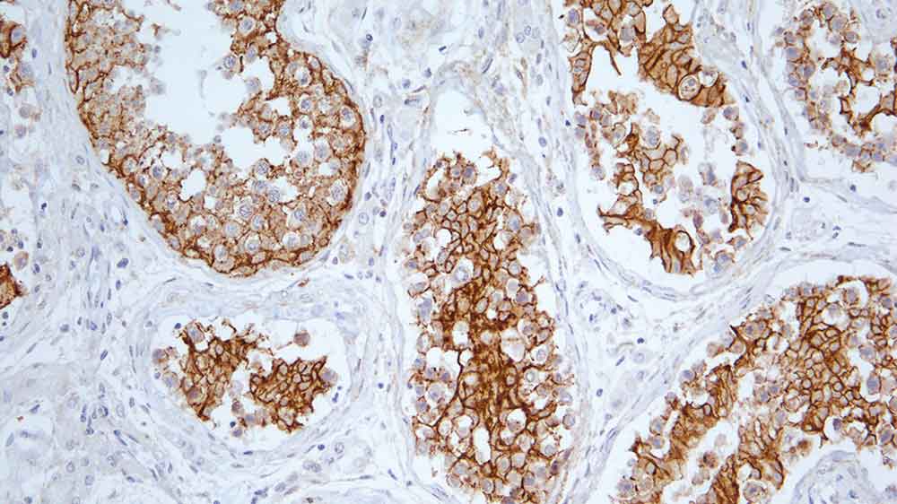 N-Cadherin product photo Front View S