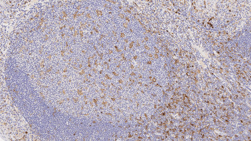 7mL TIM-3 (EPR22241) BOND RTU Primary product photo