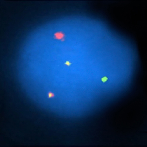 RUO - KMT2A / AFF1 product photo Front View S