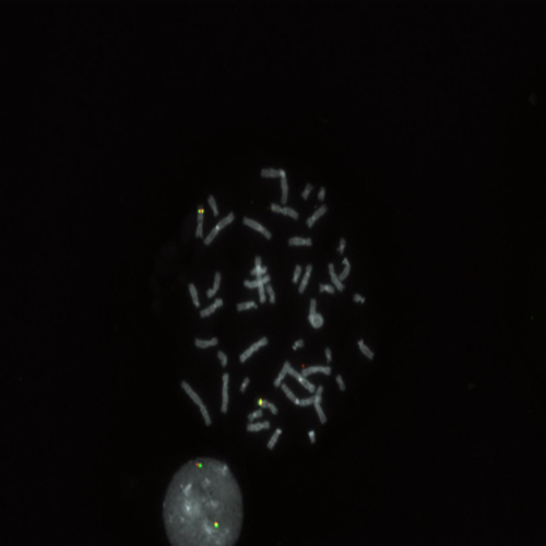 RUO - KMT2A Break Foto do produto Front View S