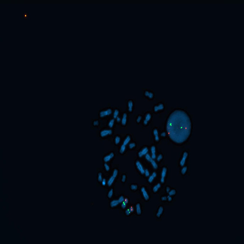 RUO - CDKN2A / 9q21 (9p21) Foto do produto Front View S