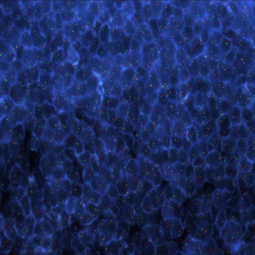 ALK (2p23 / EML4 t(2;2); inv(2) Fusion Foto do produto