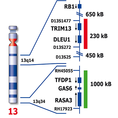 RUO - DLEU1 / 13qter Foto do produto Back View S