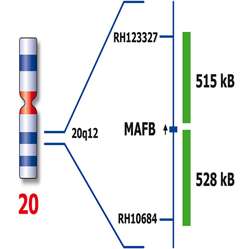 RUO - MAFB (20q12) / IGH (14q32) Foto do produto Side View S