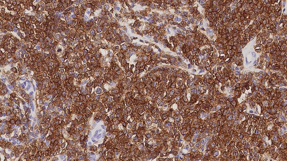 CD79a Foto do produto Front View S