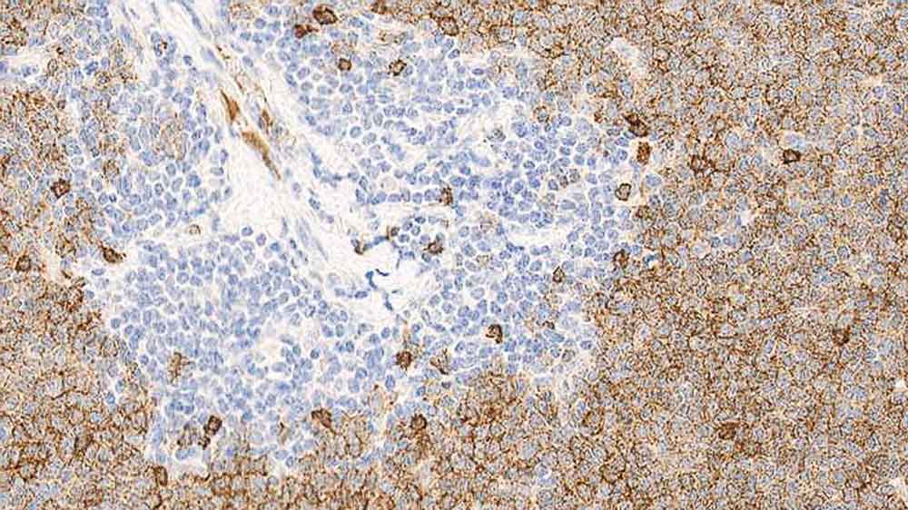 Immunoglobulin D Foto do produto Front View S