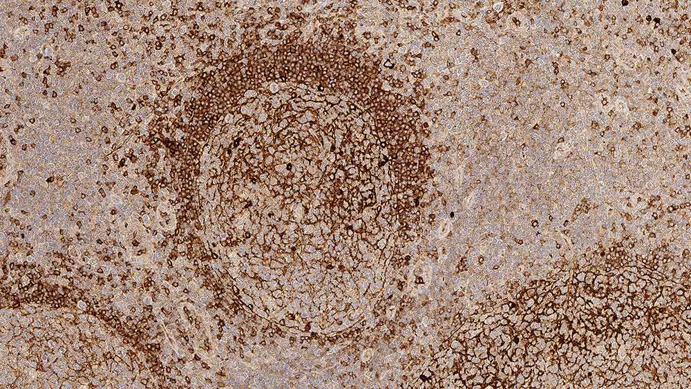 Immunoglobulin M Foto do produto Front View S