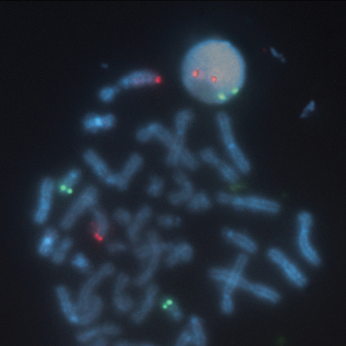 BCL2/IGH t(14;18) Fusion Foto do produto