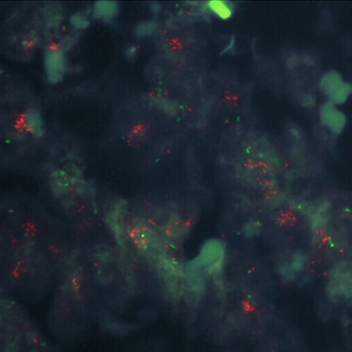 RUO - MDM2 (12q15) / SE 12 (D12Z3) Foto do produto Front View S