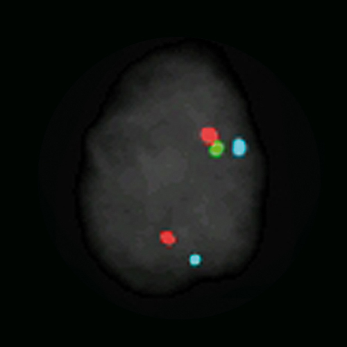 TMPRSS2-ERG (21q22) Del Break TC Foto do produto