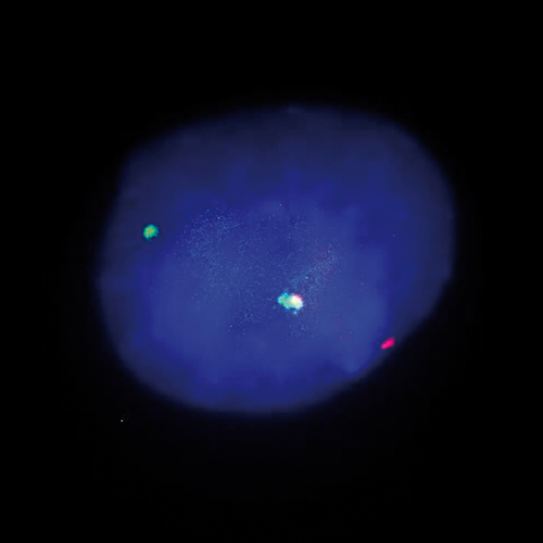 TFE3 (Xp11) Break Foto do produto