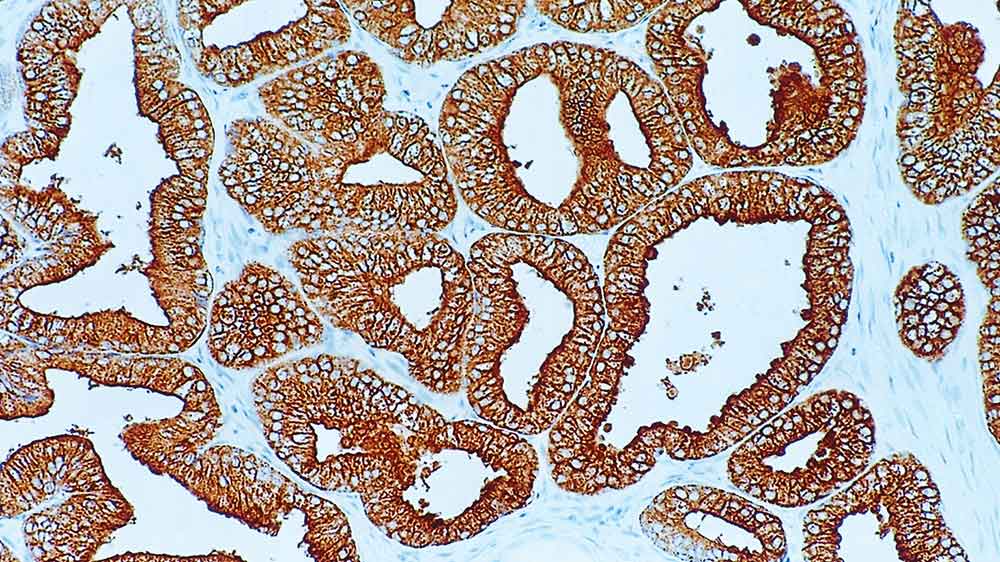 Prostatic Acid Phosphatase Foto do produto Front View S