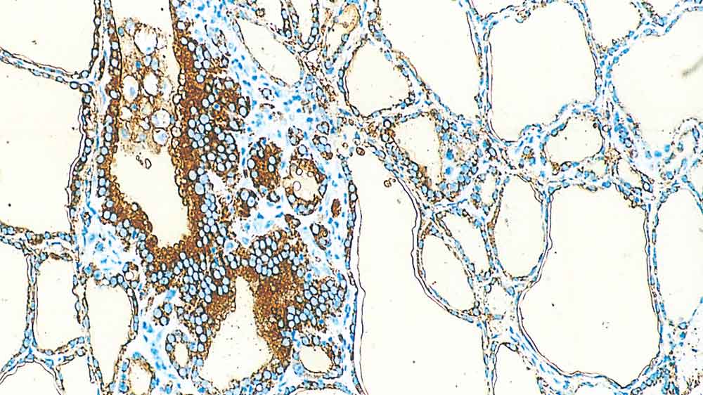 Thyroglobulin Foto do produto Front View S